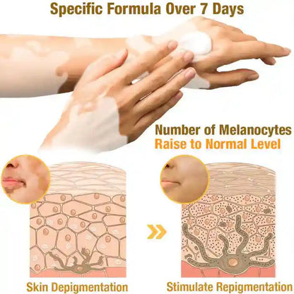 New Revitalizing Bee Venom Cream Natural Skin Restoration. Buy 1 - Get 2 Free. Pay only ₹999